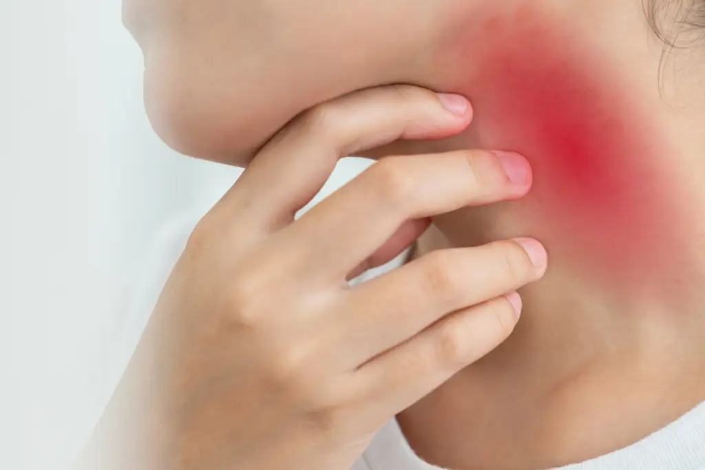 Atopijski dermatitis: kako prepoznati in lajšati simptome?